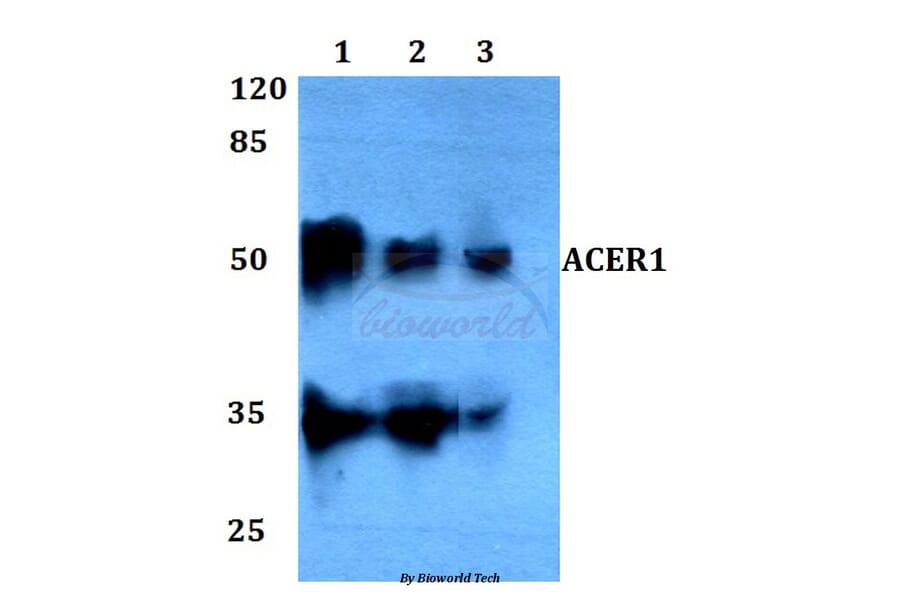 Anti-ACER1 Antibody from Bioworld Technology (BS60096) - Antibodies.com
