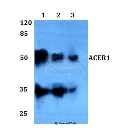 Anti-ACER1 Antibody from Bioworld Technology (BS60096) - Antibodies.com