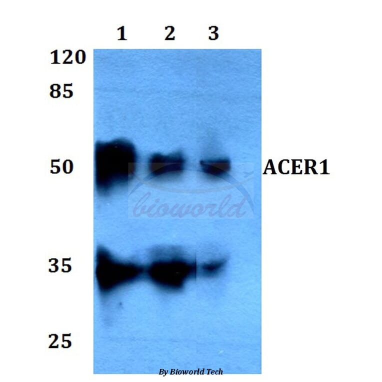 Anti-ACER1 Antibody from Bioworld Technology (BS60096) - Antibodies.com