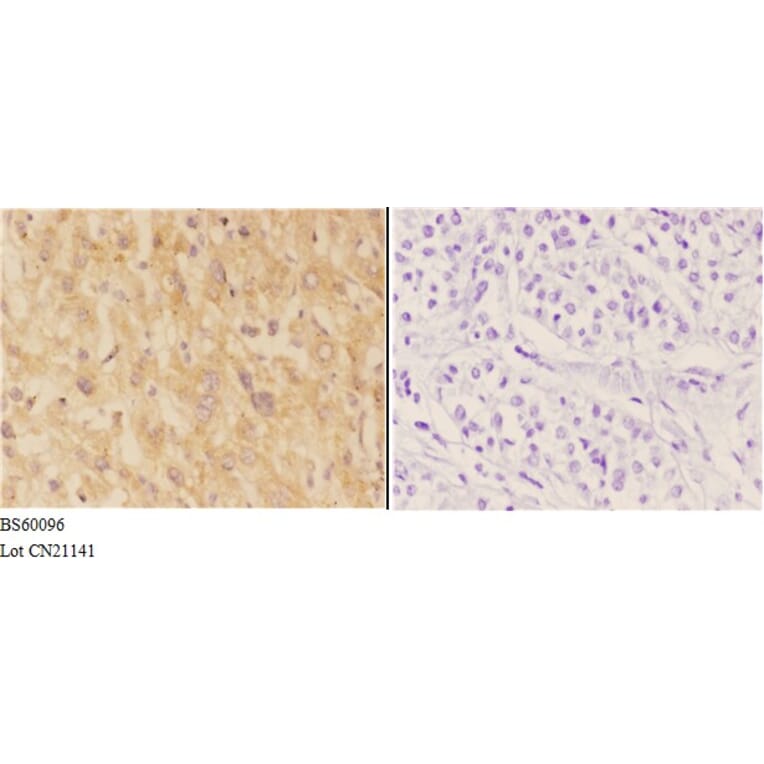 Anti-ACER1 Antibody from Bioworld Technology (BS60096) - Antibodies.com