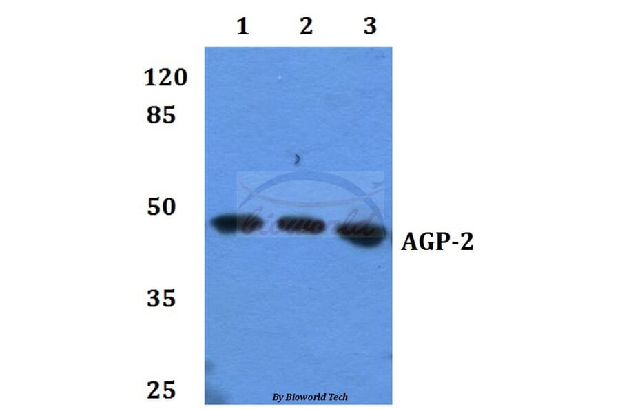 Anti-AGP-2 Antibody from Bioworld Technology (BS60097) - Antibodies.com
