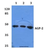 Anti-AGP-2 Antibody from Bioworld Technology (BS60097) - Antibodies.com