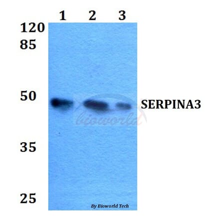 Anti-SERPINA3 Antibody from Bioworld Technology (BS60098) - Antibodies.com
