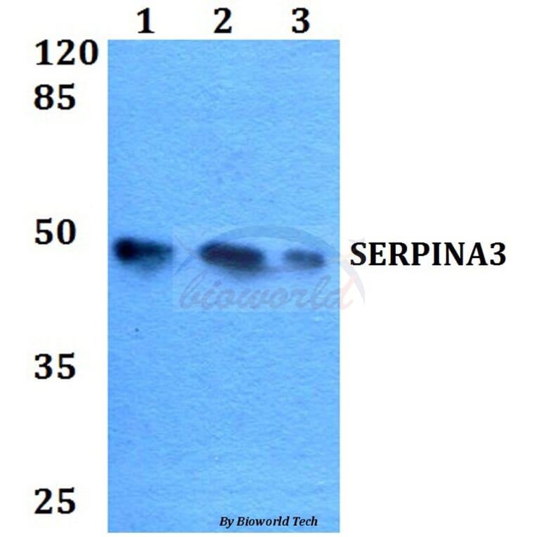 Anti-SERPINA3 Antibody from Bioworld Technology (BS60098) - Antibodies.com