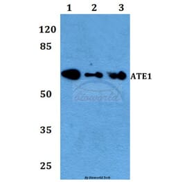 Anti-ATE1 Antibody from Bioworld Technology (BS60103) - Antibodies.com
