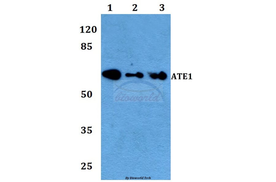 Anti-ATE1 Antibody from Bioworld Technology (BS60103) - Antibodies.com