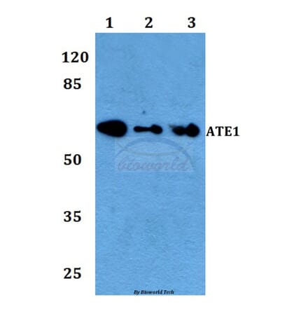 Anti-ATE1 Antibody from Bioworld Technology (BS60103) - Antibodies.com