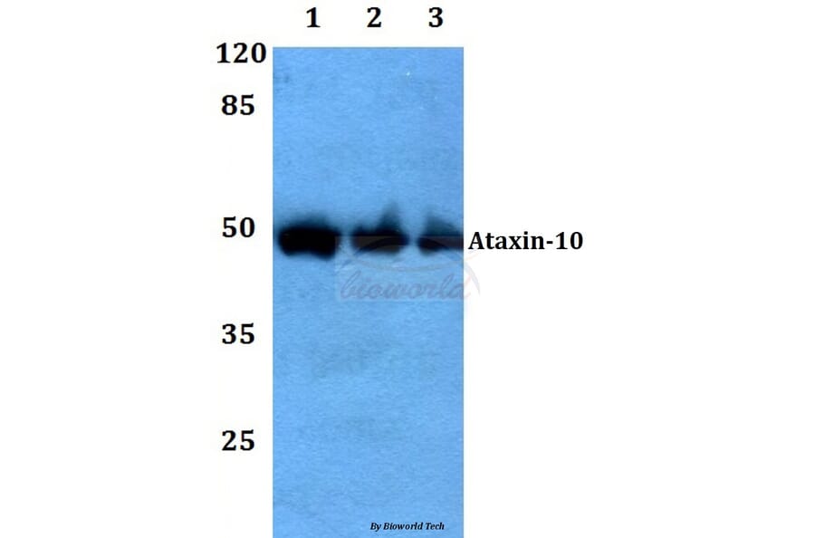 Anti-Ataxin-10 Antibody from Bioworld Technology (BS60104) - Antibodies.com