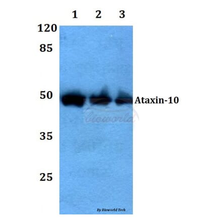 Anti-Ataxin-10 Antibody from Bioworld Technology (BS60104) - Antibodies.com