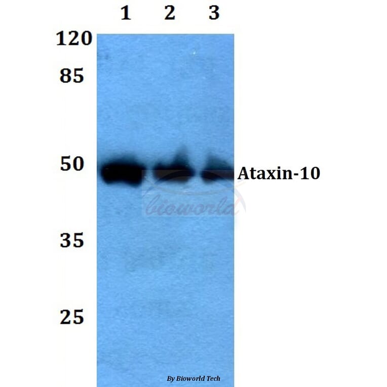 Anti-Ataxin-10 Antibody from Bioworld Technology (BS60104) - Antibodies.com