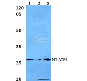 Anti-MT-ATP6 Antibody from Bioworld Technology (BS60105) - Antibodies.com