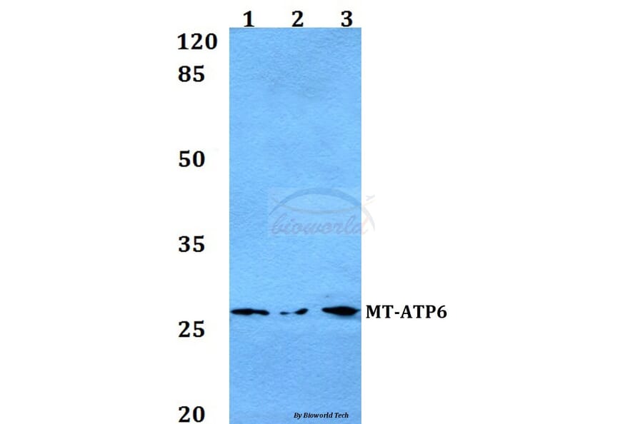 Anti-MT-ATP6 Antibody from Bioworld Technology (BS60105) - Antibodies.com