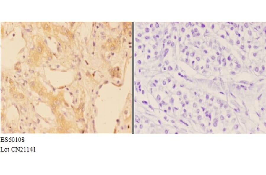 Anti-ABCA7 Antibody from Bioworld Technology (BS60108) - Antibodies.com
