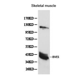 Anti-BVES Antibody from Bioworld Technology (BS6011) - Antibodies.com