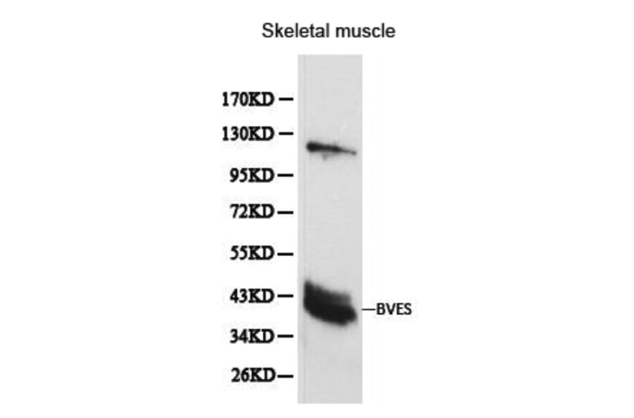 Anti-BVES Antibody from Bioworld Technology (BS6011) - Antibodies.com