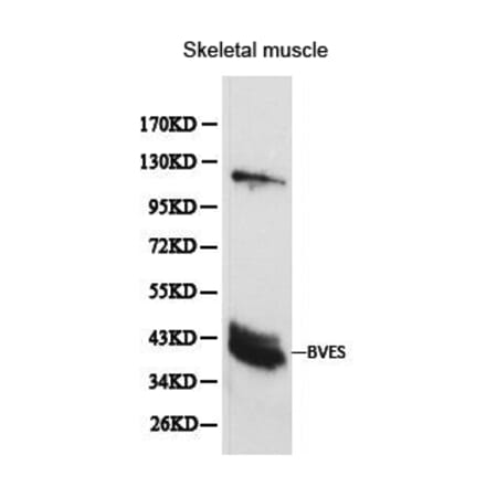 Anti-BVES Antibody from Bioworld Technology (BS6011) - Antibodies.com