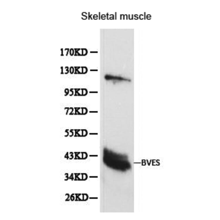 Anti-BVES Antibody from Bioworld Technology (BS6011) - Antibodies.com