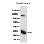 Anti-BVES Antibody from Bioworld Technology (BS6011) - Antibodies.com