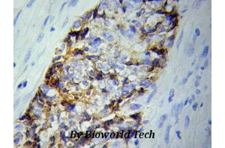 Anti-BVES Antibody from Bioworld Technology (BS6011) - Antibodies.com