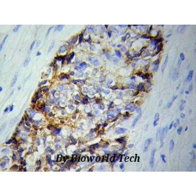 Anti-BVES Antibody from Bioworld Technology (BS6011) - Antibodies.com