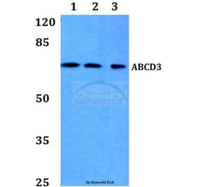 Anti-ABCD3 Antibody from Bioworld Technology (BS60111) - Antibodies.com