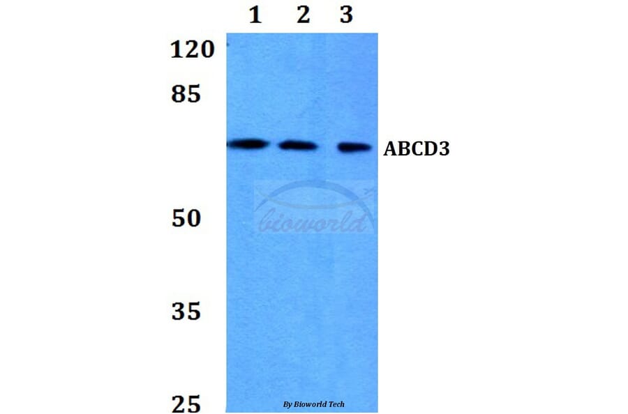 Anti-ABCD3 Antibody from Bioworld Technology (BS60111) - Antibodies.com