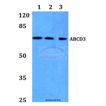 Anti-ABCD3 Antibody from Bioworld Technology (BS60111) - Antibodies.com