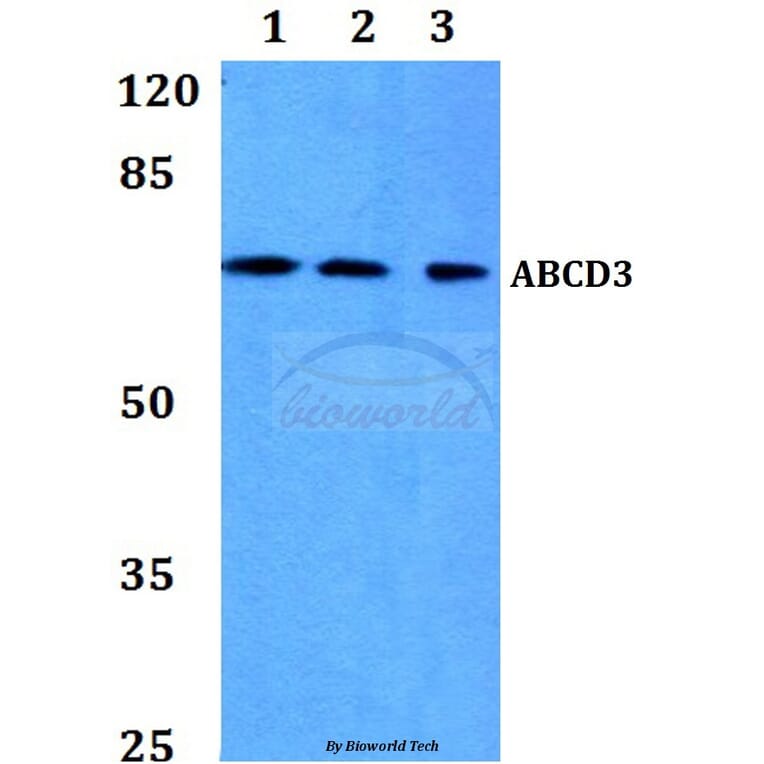 Anti-ABCD3 Antibody from Bioworld Technology (BS60111) - Antibodies.com