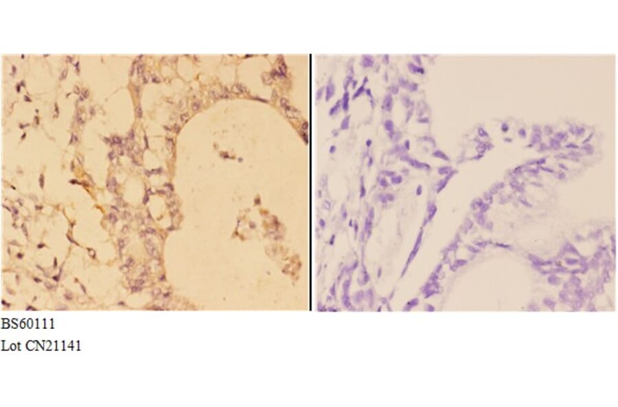 Anti-ABCD3 Antibody from Bioworld Technology (BS60111) - Antibodies.com