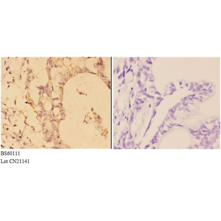 Anti-ABCD3 Antibody from Bioworld Technology (BS60111) - Antibodies.com