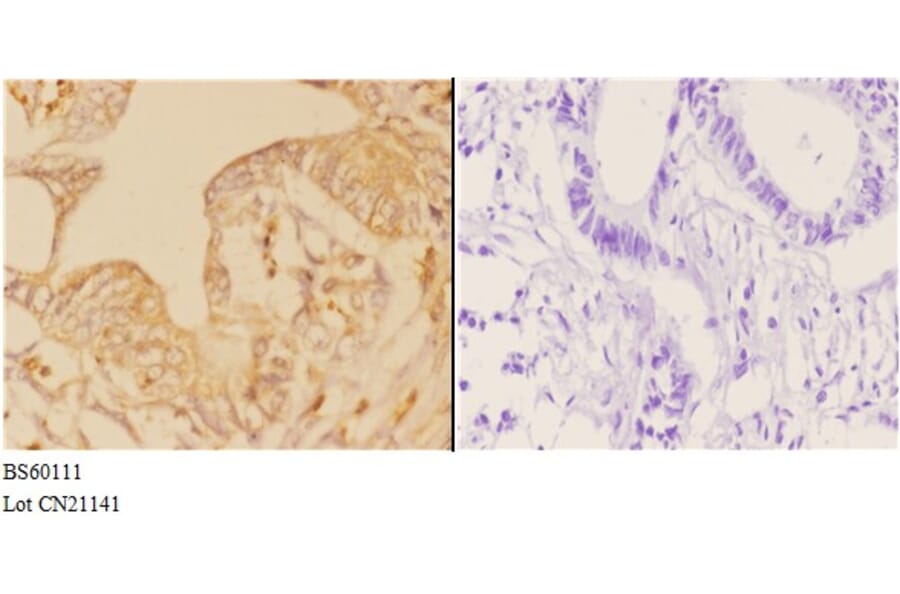 Anti-ABCD3 Antibody from Bioworld Technology (BS60111) - Antibodies.com