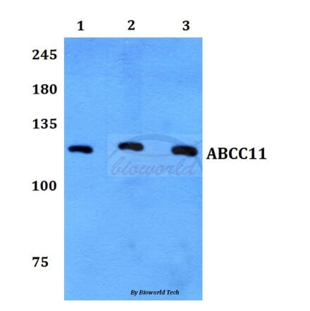 Anti-ABCC11 Antibody from Bioworld Technology (BS60113) - Antibodies.com