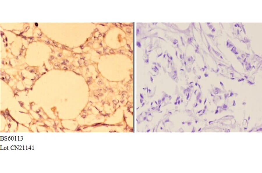 Anti-ABCC11 Antibody from Bioworld Technology (BS60113) - Antibodies.com