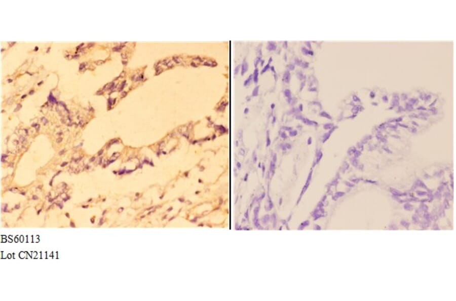 Anti-ABCC11 Antibody from Bioworld Technology (BS60113) - Antibodies.com