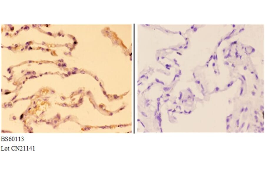 Anti-ABCC11 Antibody from Bioworld Technology (BS60113) - Antibodies.com