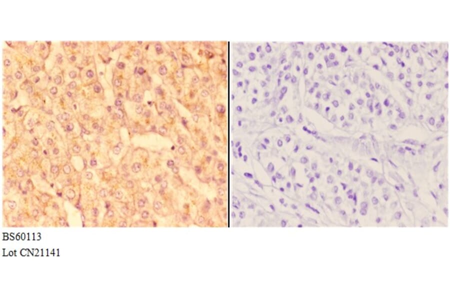 Anti-ABCC11 Antibody from Bioworld Technology (BS60113) - Antibodies.com