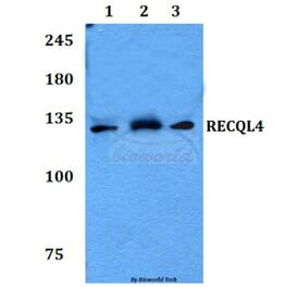 Anti-RECQL4 Antibody from Bioworld Technology (BS60115) - Antibodies.com