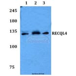 Anti-RECQL4 Antibody from Bioworld Technology (BS60115) - Antibodies.com