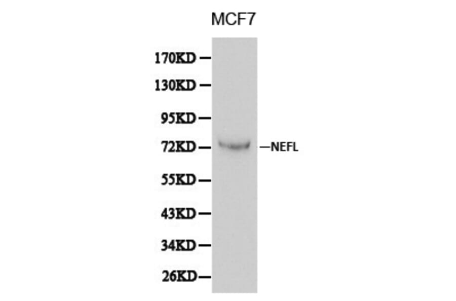Anti-NEFL Antibody from Bioworld Technology (BS6012) - Antibodies.com