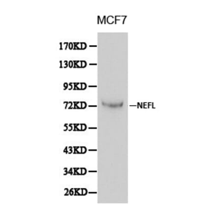 Anti-NEFL Antibody from Bioworld Technology (BS6012) - Antibodies.com