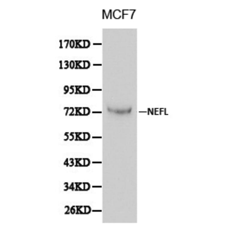 Anti-NEFL Antibody from Bioworld Technology (BS6012) - Antibodies.com