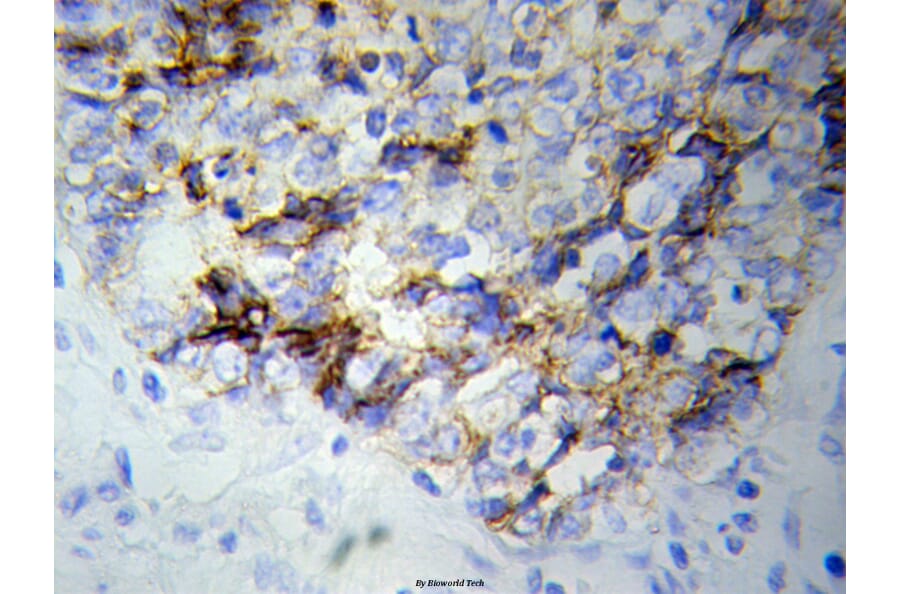 Anti-NEFL Antibody from Bioworld Technology (BS6012) - Antibodies.com