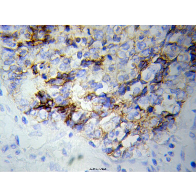Anti-NEFL Antibody from Bioworld Technology (BS6012) - Antibodies.com