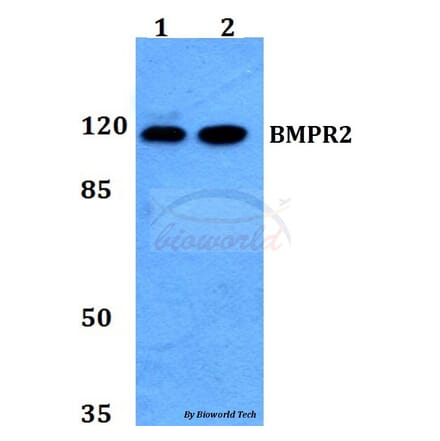 Anti-BMPR2 Antibody from Bioworld Technology (BS60120) - Antibodies.com