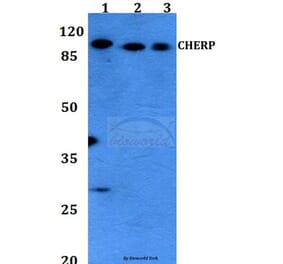 Anti-CHERP Antibody from Bioworld Technology (BS60123) - Antibodies.com