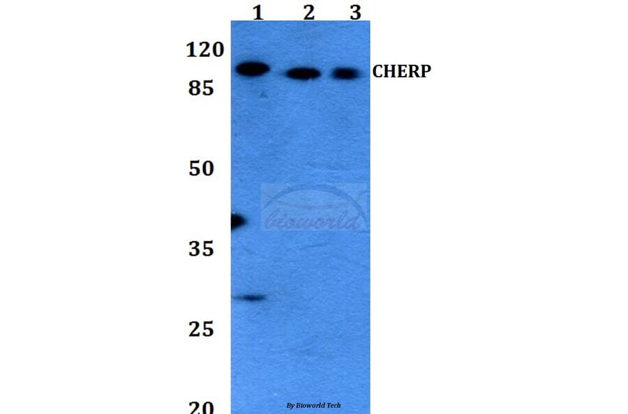 Anti-CHERP Antibody from Bioworld Technology (BS60123) - Antibodies.com