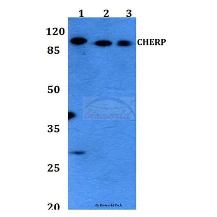 Anti-CHERP Antibody from Bioworld Technology (BS60123) - Antibodies.com