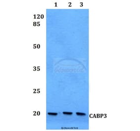 Anti-CABP3 Antibody from Bioworld Technology (BS60125) - Antibodies.com