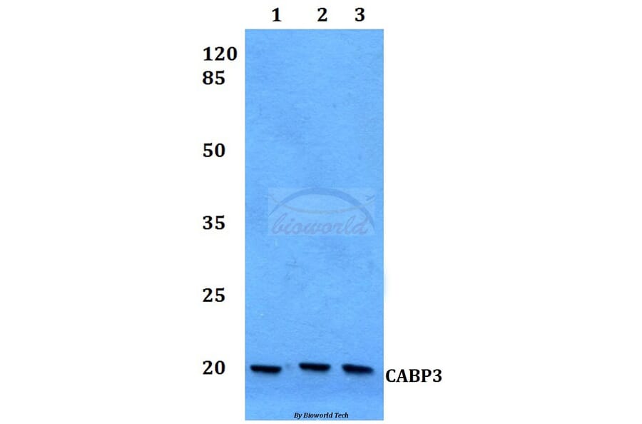 Anti-CABP3 Antibody from Bioworld Technology (BS60125) - Antibodies.com