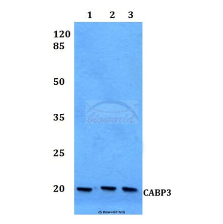 Anti-CABP3 Antibody from Bioworld Technology (BS60125) - Antibodies.com